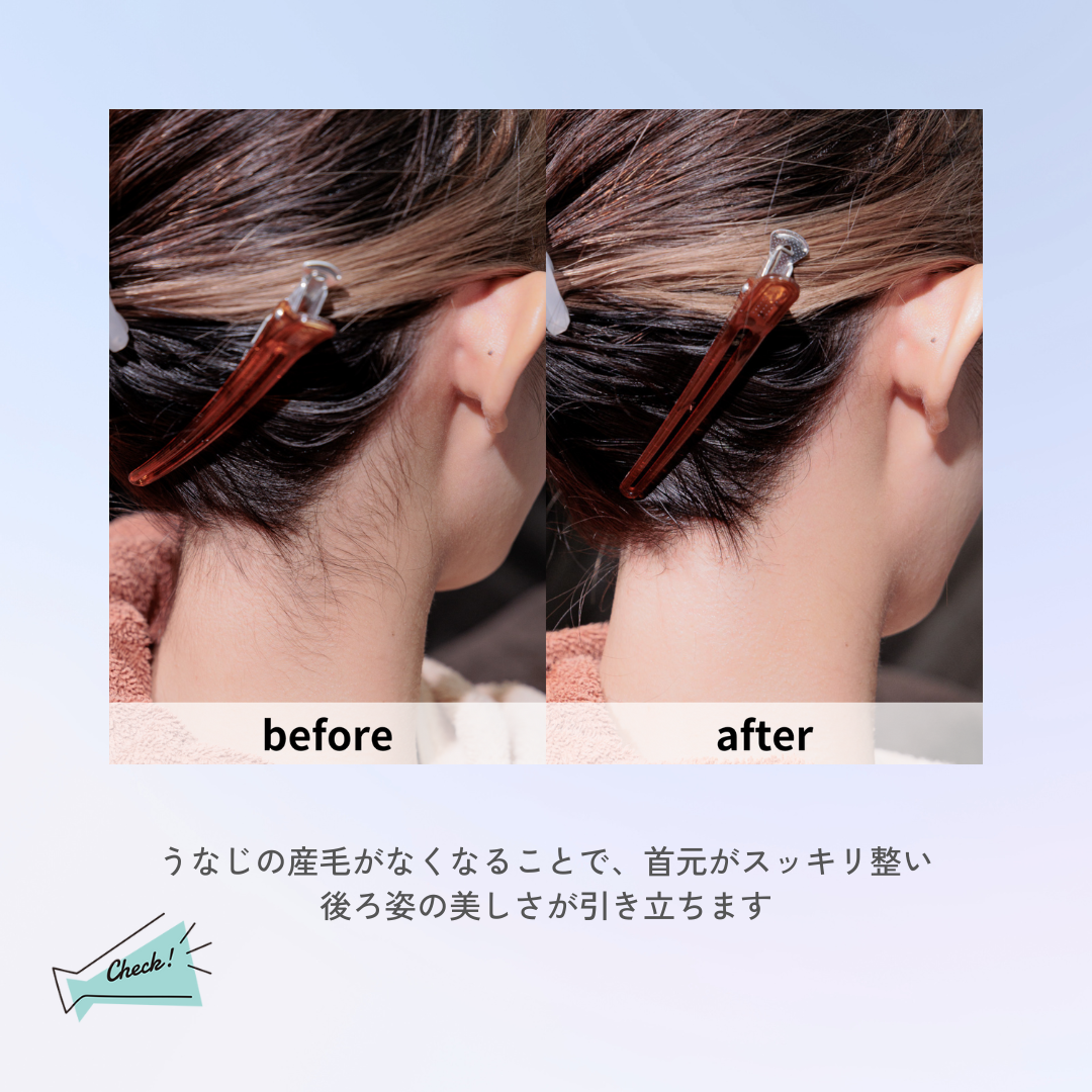 うなじの産毛がなくなることで首いが