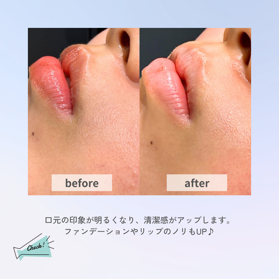口元ビフォアフ