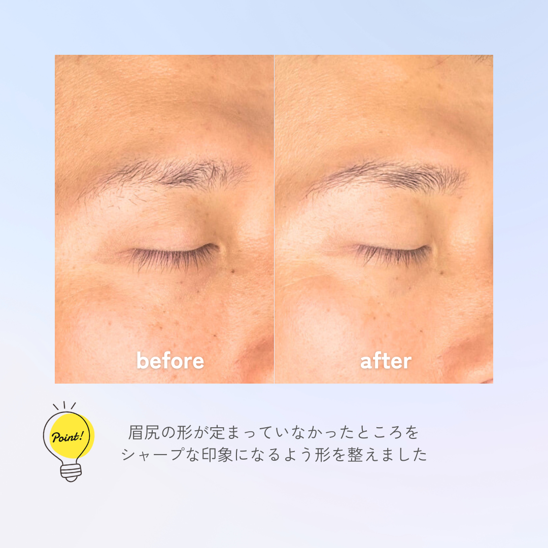 眉毛ビフォアフ２