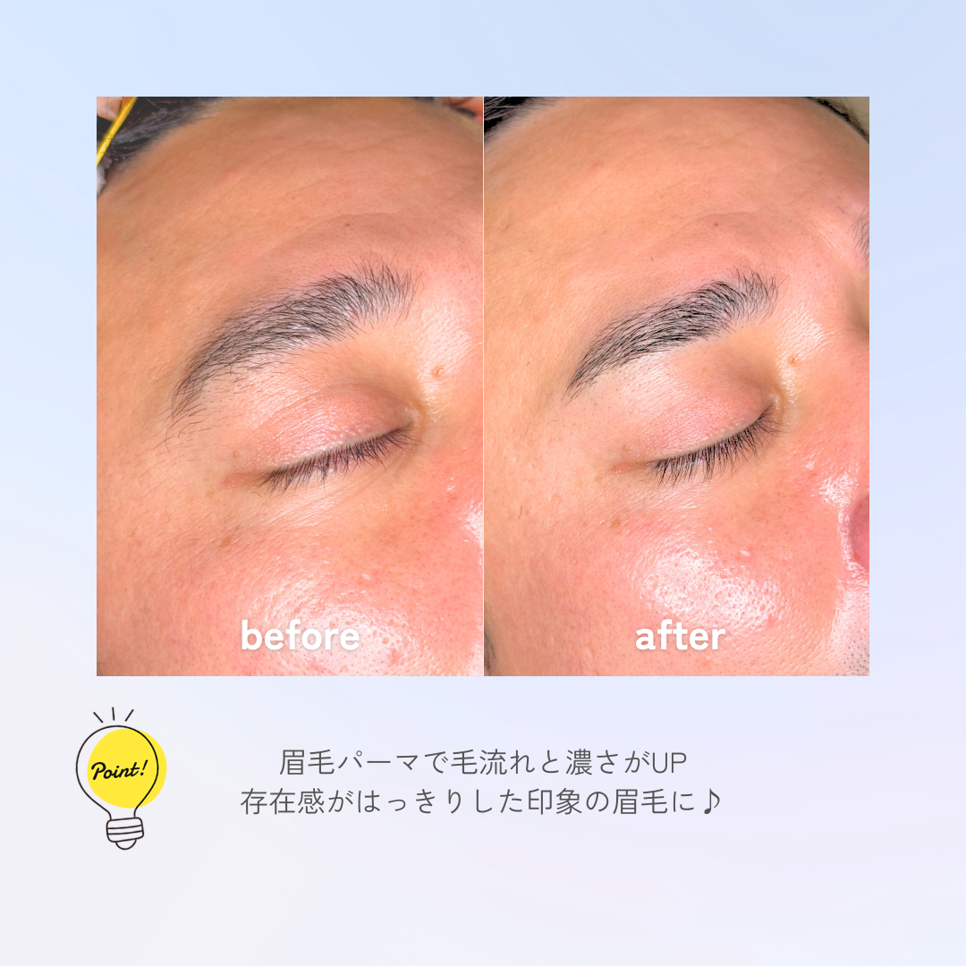 眉毛ビフォアフ３